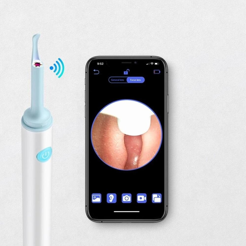 Wireless 3.9mm HD Ear Camera: Luminous Ear Cleaner & Otoscope - Picture 4 of 5